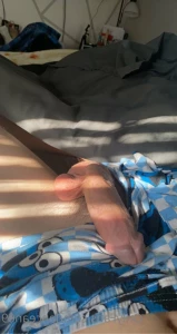 15848731