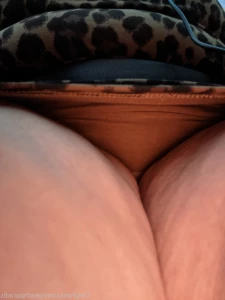 15545177