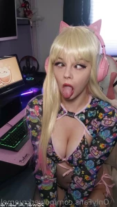 15555712