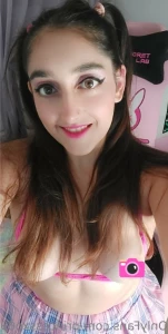 15567665