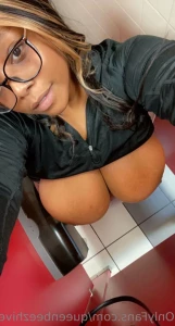 16240624
