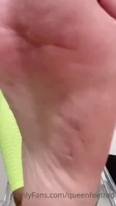 18082772