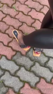 18082778