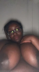 16132956