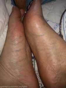 14280141