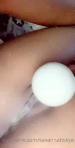 18079532