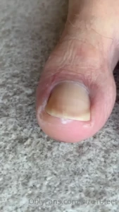 12464610