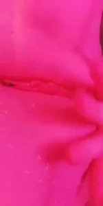 18077582