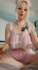 18077602