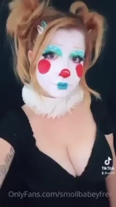 18077218