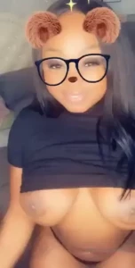 18076914