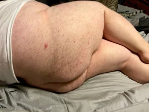 14242201