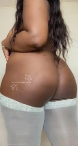 16174428