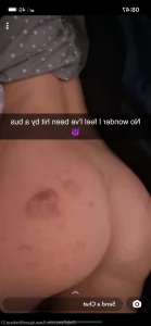 16226411