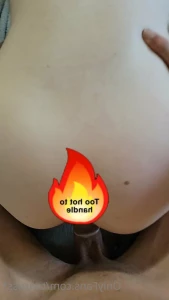16245319