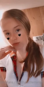 15181425