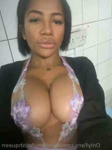 12646210
