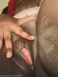 14755468