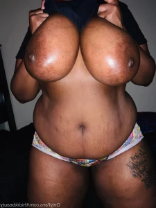 15265318