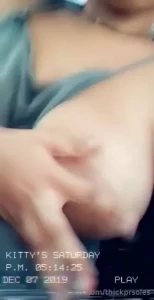 18073794