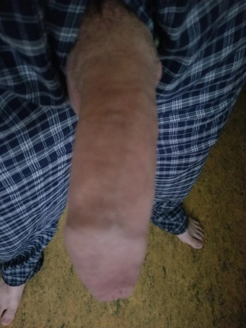 Tommy Pistol [ tommypistol ] Onlyfans leaked photo 13060454 on Hotleaks.tv
