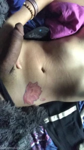 15569071