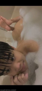 15569164