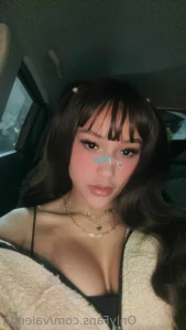 11662575