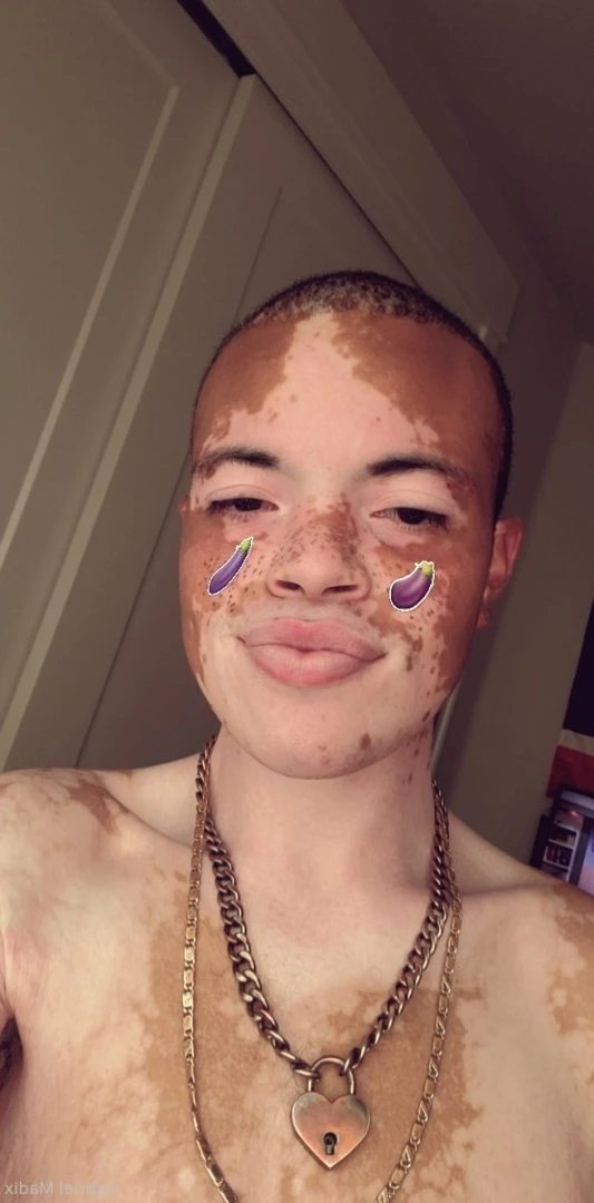 Gabriel [ vitiligoftmboi ] Onlyfans leaked photo 17684365 on Hotleaks.tv