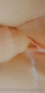 15514287