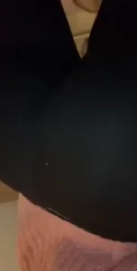 18067995