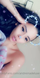 16452099