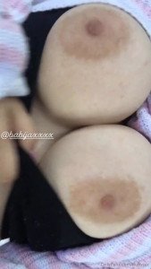 15778016