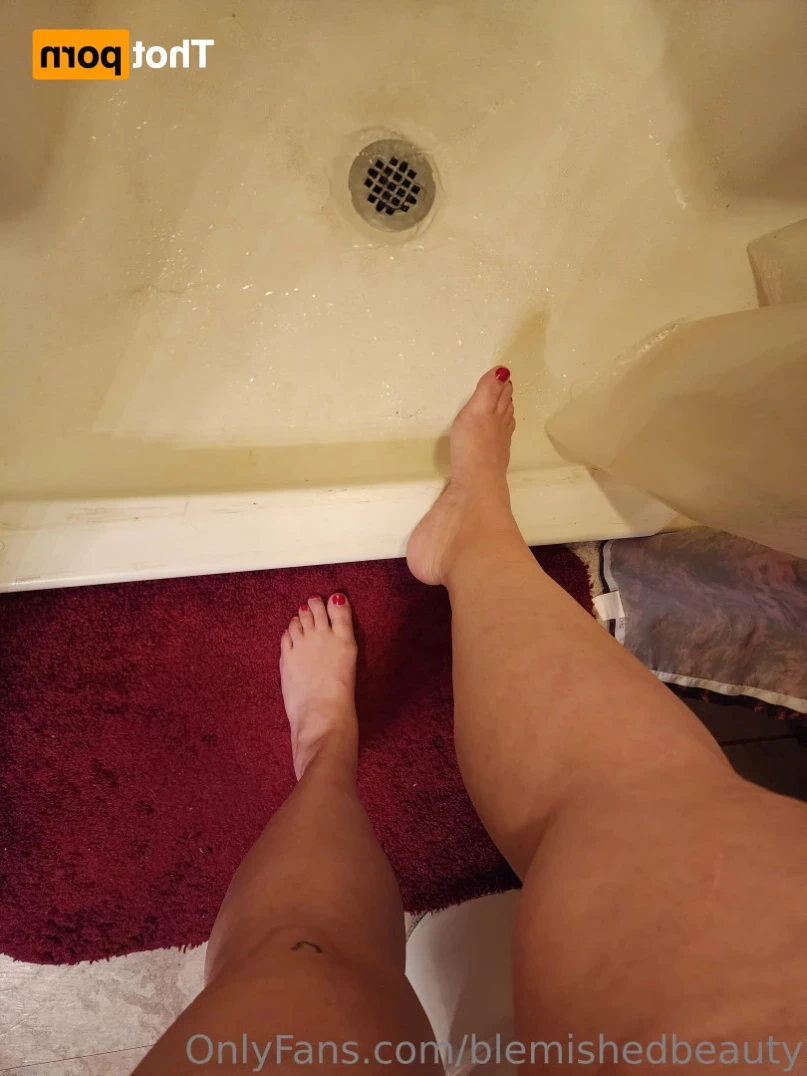 Blemished Beauty [ blemishedbeauty ] Onlyfans leaked photo 10866053 on Hotleaks.tv