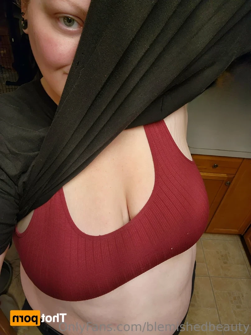 Blemished Beauty [ blemishedbeauty ] Onlyfans leaked photo 11373737 on Hotleaks.tv