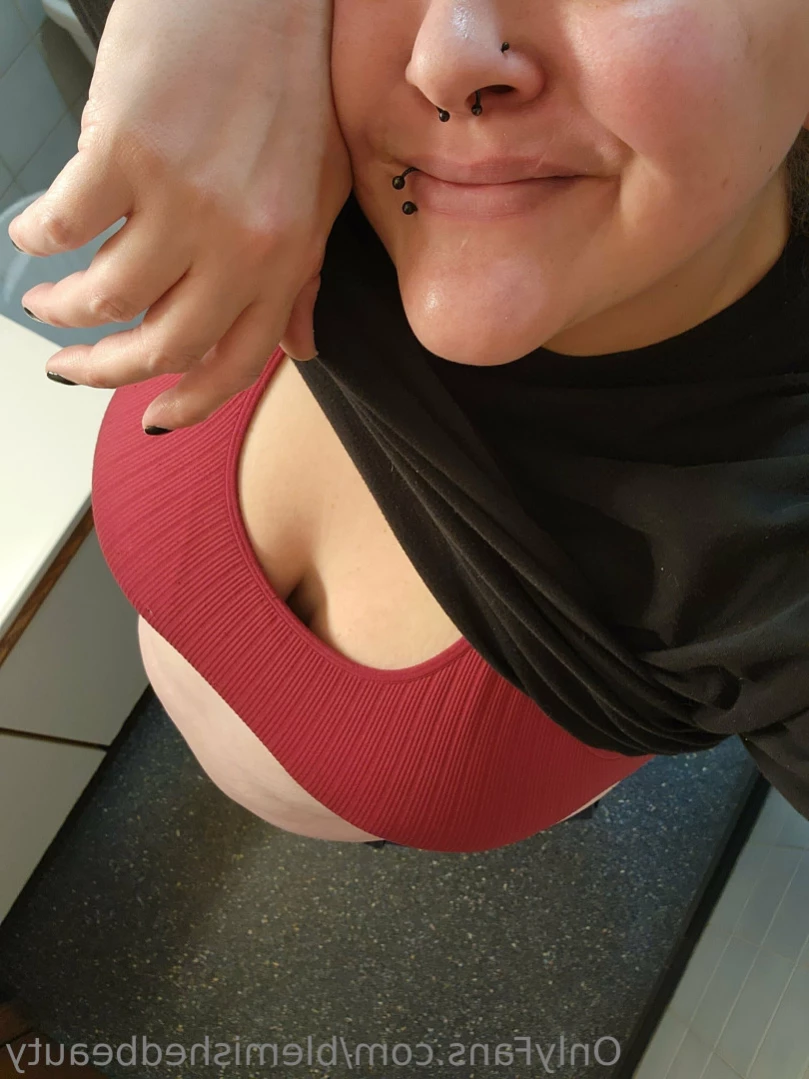 Blemished Beauty [ blemishedbeauty ] Onlyfans leaked photo 11448454 on Hotleaks.tv