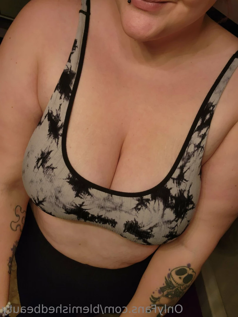 Blemished Beauty [ blemishedbeauty ] Onlyfans leaked photo 12232285 on Hotleaks.tv