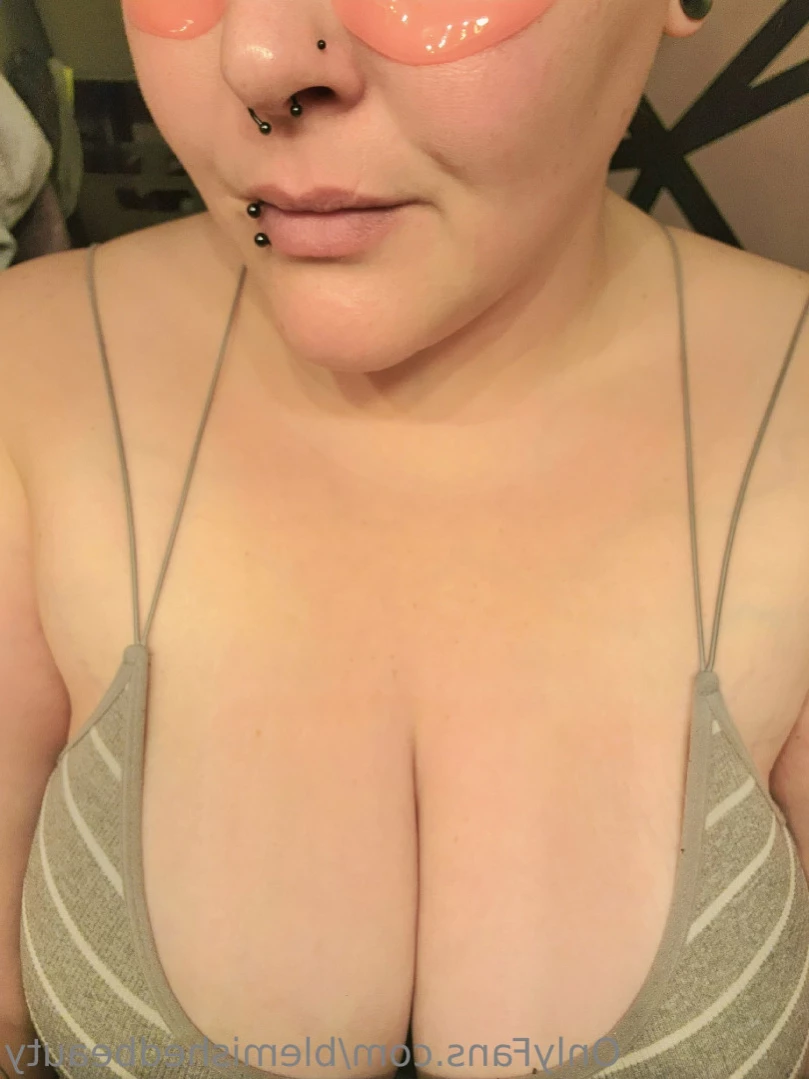 Blemished Beauty [ blemishedbeauty ] Onlyfans leaked photo 12594610 on Hotleaks.tv