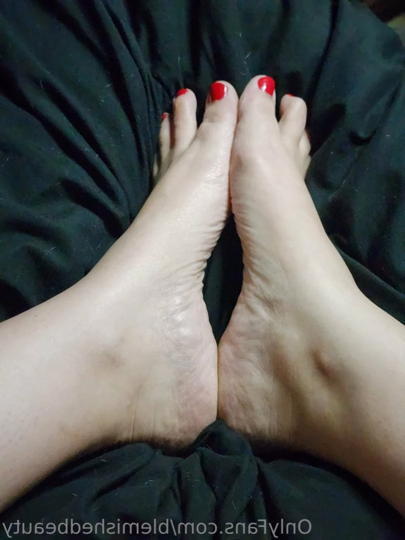 Blemished Beauty [ blemishedbeauty ] Onlyfans leaked photo 12600415 on Hotleaks.tv