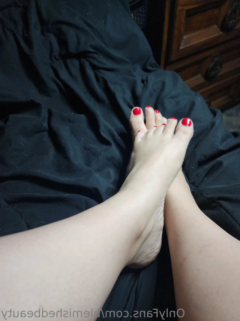 Blemished Beauty [ blemishedbeauty ] Onlyfans leaked photo 12608253 on Hotleaks.tv