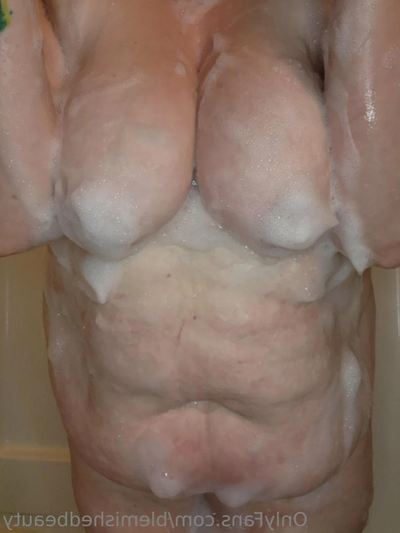 Blemished Beauty [ blemishedbeauty ] Onlyfans leaked photo 12678995 on Hotleaks.tv