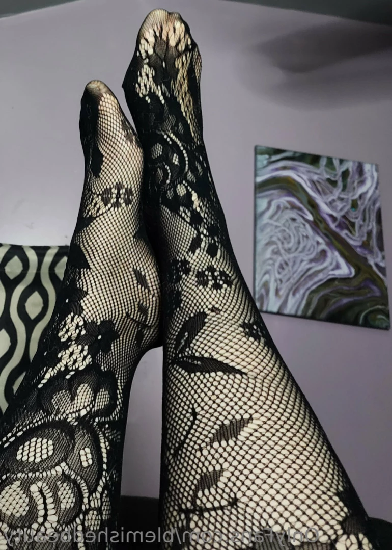 Blemished Beauty [ blemishedbeauty ] Onlyfans leaked photo 12681536 on Hotleaks.tv