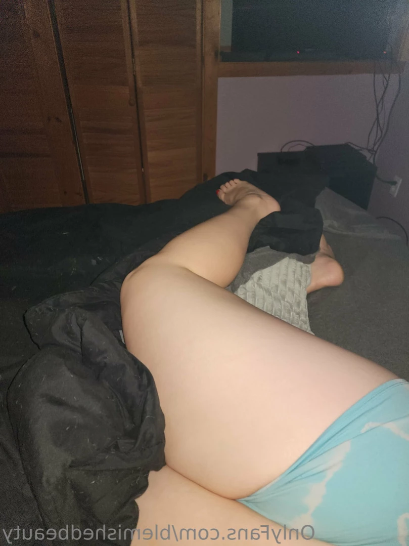 Blemished Beauty [ blemishedbeauty ] Onlyfans leaked photo 12688148 on Hotleaks.tv