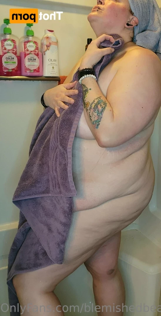 Blemished Beauty [ blemishedbeauty ] Onlyfans leaked photo 13325502 on Hotleaks.tv