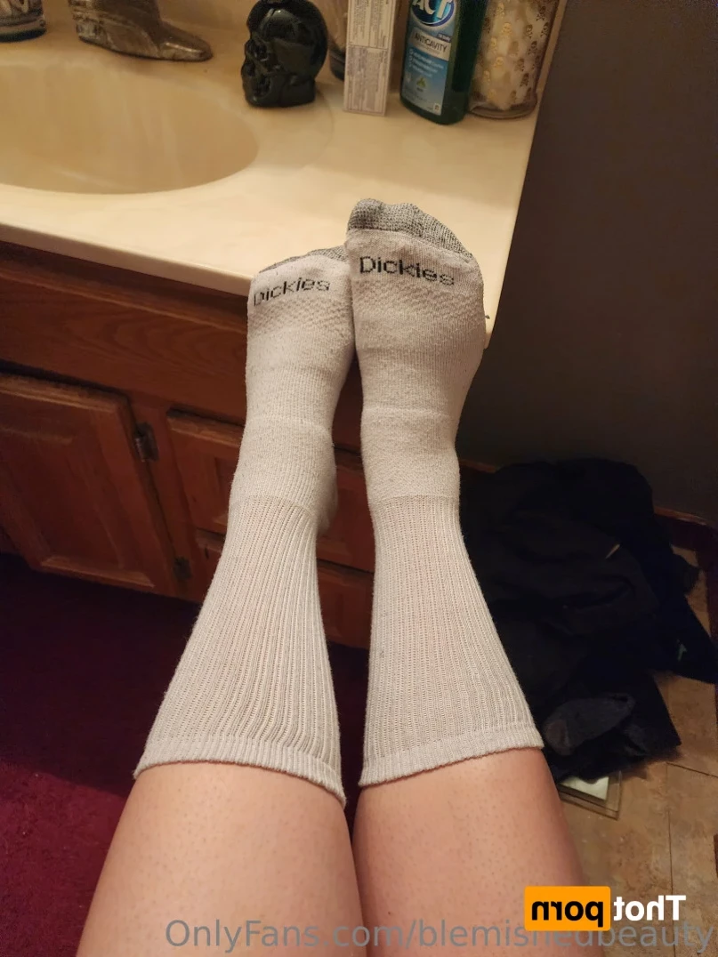 Blemished Beauty [ blemishedbeauty ] Onlyfans leaked photo 14832318 on Hotleaks.tv