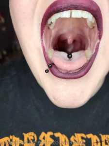15775385