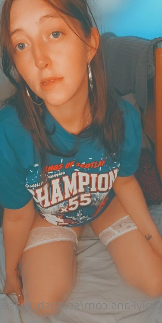 ~ScottishGinger~🌻🌙 [ scottish_tease ] Onlyfans leaked photo 11974417 on Hotleaks.tv