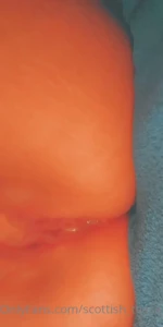 15141255