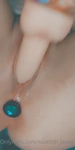 15566868