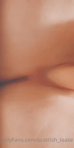 16207814